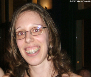 Marie-Hélène Cyr - Before orthognathic surgeries (September 8, 2007)